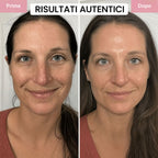 Maschera al Collagene ultra-assorbibile