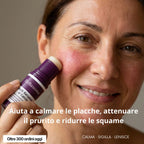 Balsamo al Calcio per Psoriasi e Eczema